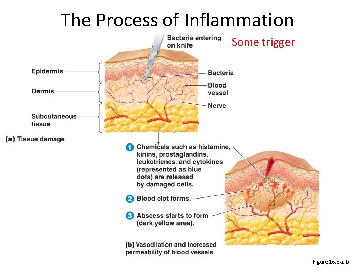 The Process of Inflammation Some trigger Figure 16. 8 a, b 