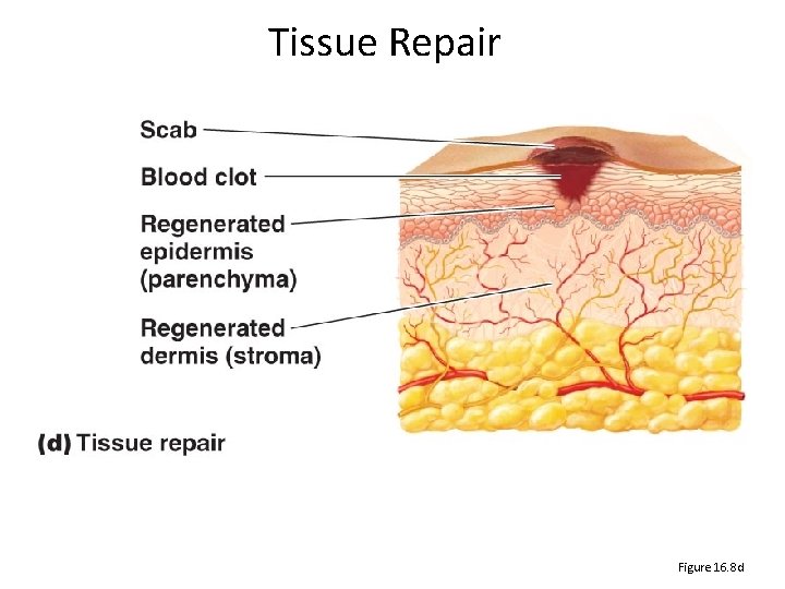 Tissue Repair Figure 16. 8 d 