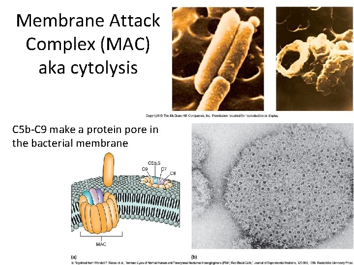 Membrane Attack Complex (MAC) aka cytolysis C 5 b‐C 9 make a protein pore