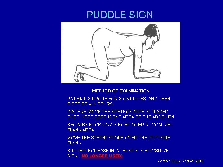 PUDDLE SIGN METHOD OF EXAMINATION PATIENT IS PRONE FOR 3 -5 MINUTES AND THEN
