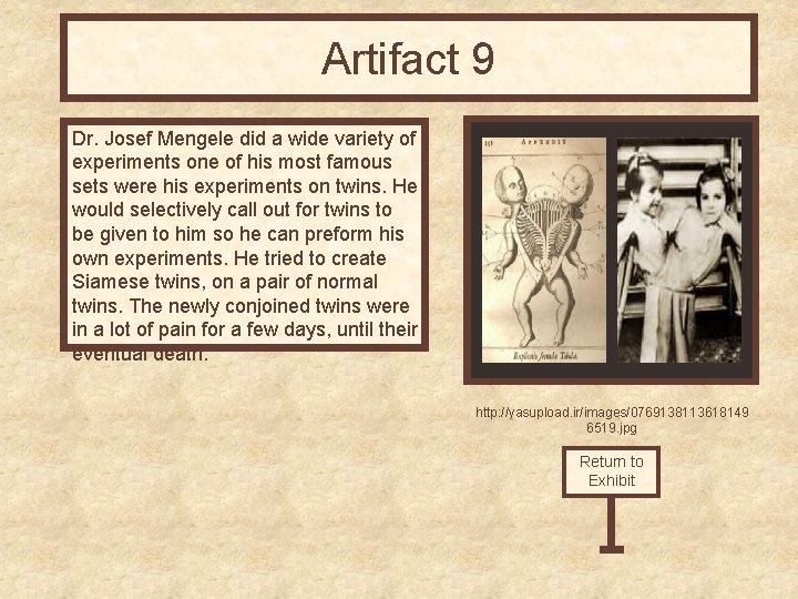 Artifact 9 Dr. Josef Mengele did a wide variety of experiments one of his