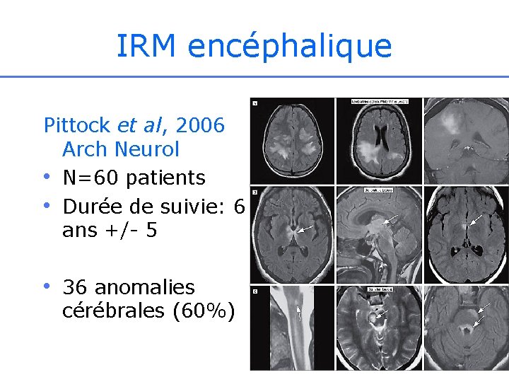 IRM encéphalique Pittock et al, 2006 Arch Neurol • N=60 patients • Durée de