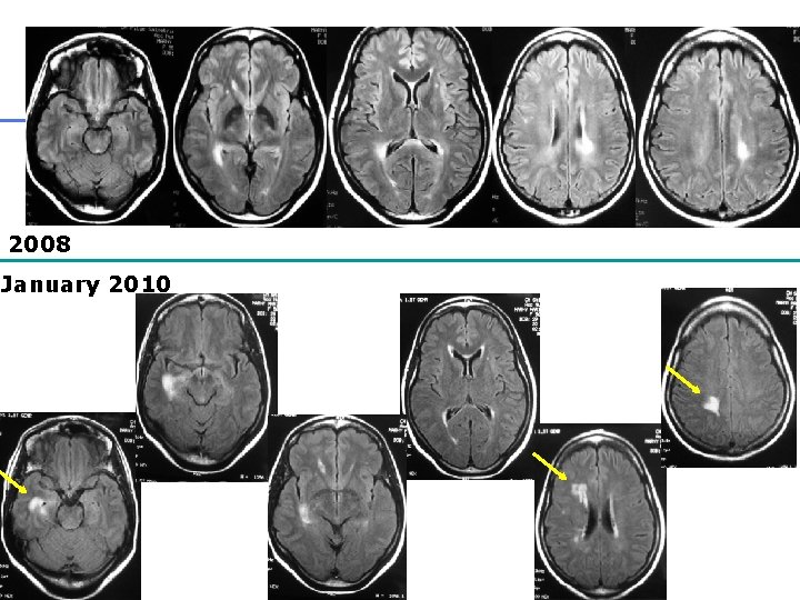 2008 January 2010 32 