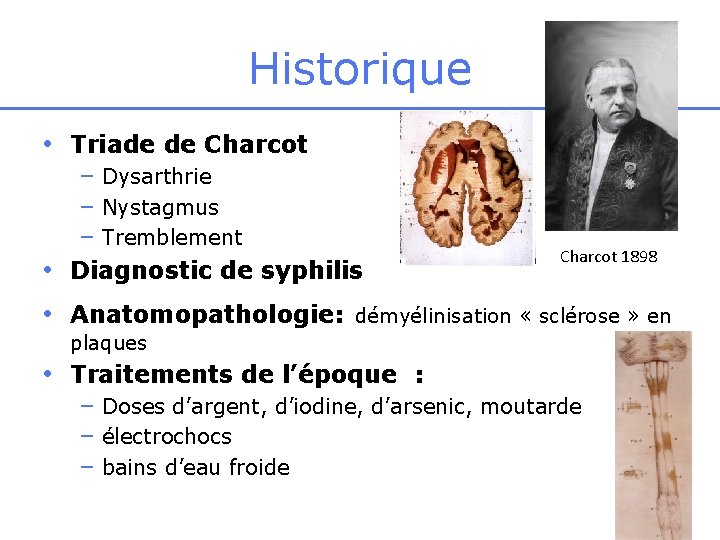 Historique • Triade de Charcot – Dysarthrie – Nystagmus – Tremblement • Diagnostic de