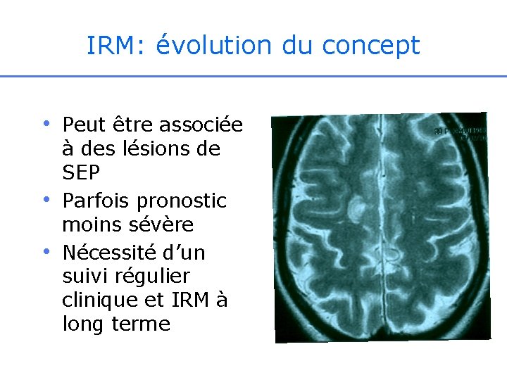 IRM: évolution du concept • Peut être associée • • à des lésions de