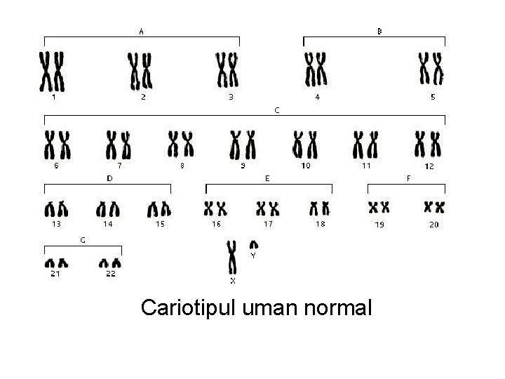 Cariotipul uman normal 