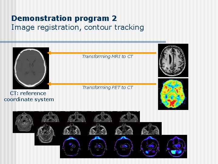 Demonstration program 2 Image registration, contour tracking Transforming MRI to CT Transforming PET to Demonstration program 2 Image registration, contour tracking Transforming MRI to CT Transforming PET to