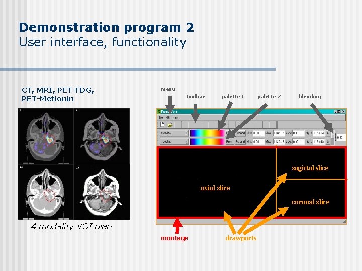 Demonstration program 2 User interface, functionality CT, MRI, PET-FDG, PET-Metionin menu toolbar palette 1 Demonstration program 2 User interface, functionality CT, MRI, PET-FDG, PET-Metionin menu toolbar palette 1