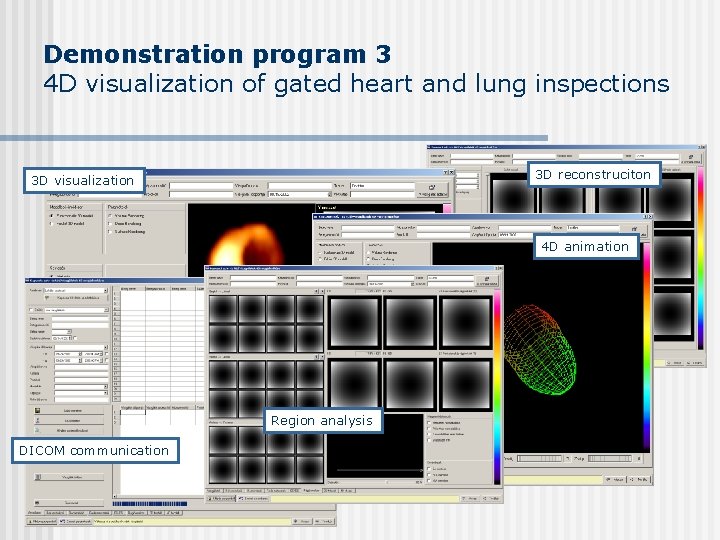 Demonstration program 3 4 D visualization of gated heart and lung inspections 3 D Demonstration program 3 4 D visualization of gated heart and lung inspections 3 D