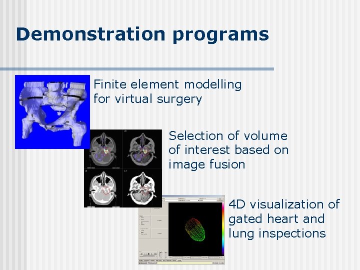 Demonstration programs Finite element modelling for virtual surgery Selection of volume of interest based Demonstration programs Finite element modelling for virtual surgery Selection of volume of interest based