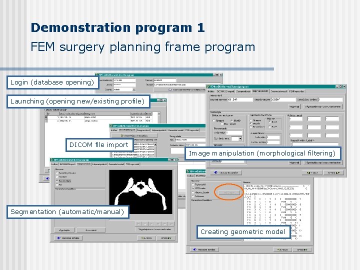 Demonstration program 1 FEM surgery planning frame program Login (database opening) Launching (opening new/existing Demonstration program 1 FEM surgery planning frame program Login (database opening) Launching (opening new/existing