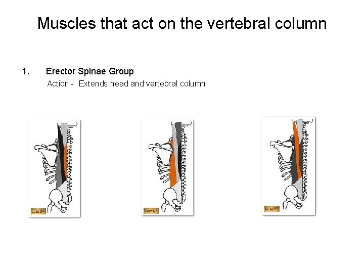 Muscles that act on the vertebral column 1. Erector Spinae Group Action - Extends