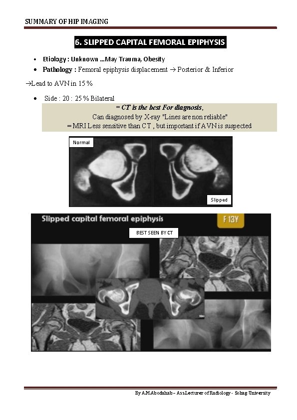 SUMMARY OF HIP IMAGING 6. SLIPPED CAPITAL FEMORAL EPIPHYSIS Etiology : Unknown …May Trauma,