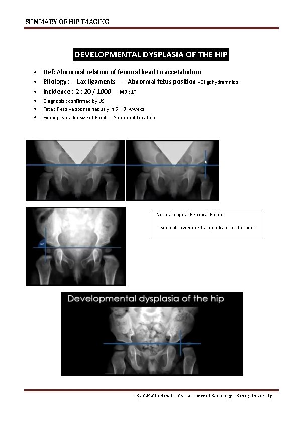SUMMARY OF HIP IMAGING DEVELOPMENTAL DYSPLASIA OF THE HIP Def: Abnormal relation of femoral