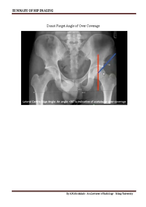 SUMMARY OF HIP IMAGING Donot Forget Angle of Over Coverage By A. M. Abodahab