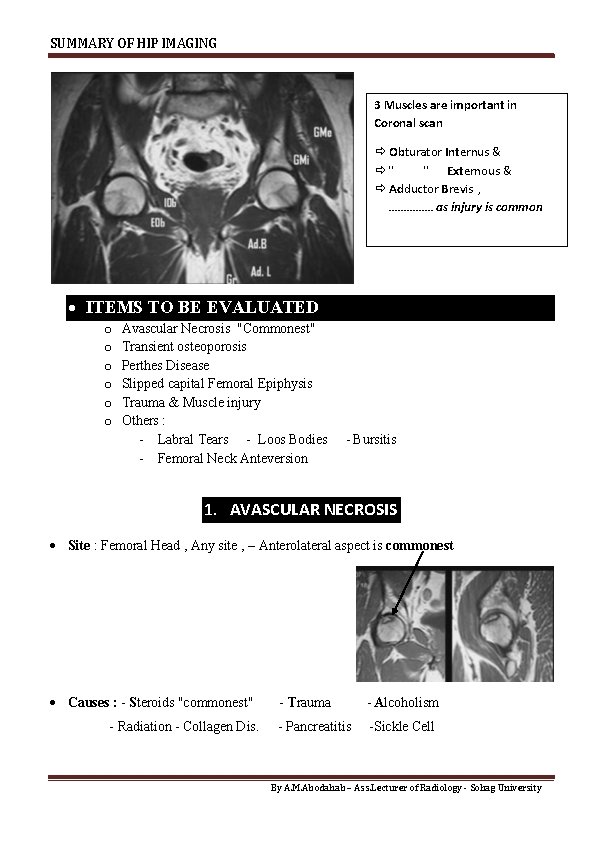SUMMARY OF HIP IMAGING 3 Muscles are important in Coronal scan Obturator Internus &