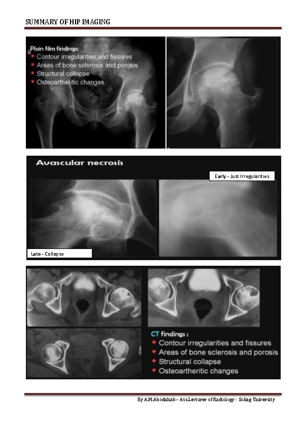 SUMMARY OF HIP IMAGING Late - Collapse Early - Just Irregularities Late - Collapse