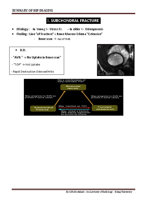 SUMMARY OF HIP IMAGING 3. SUBCHONDRAL FRACTURE Etiology : -In Young Stress Fr. –