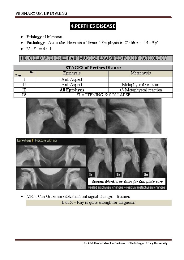 SUMMARY OF HIP IMAGING 4. PERTHES DISEASE Etiology : Unknown Pathology : Avascular Necrosis