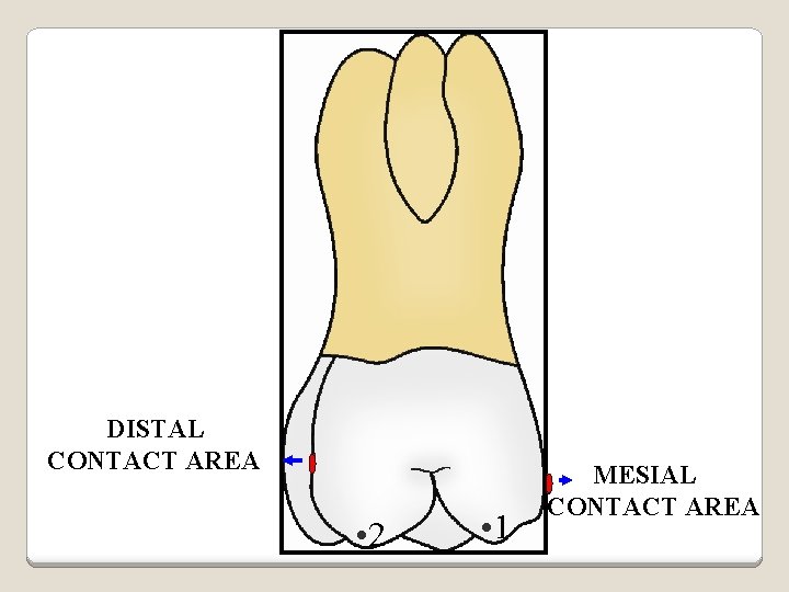 DISTAL CONTACT AREA • 2 • 1 MESIAL CONTACT AREA 