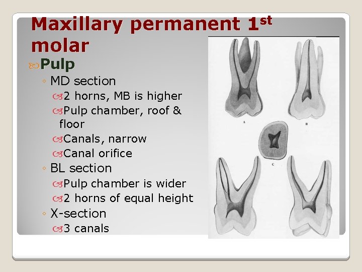 Maxillary permanent 1 st molar Pulp ◦ MD section 2 horns, MB is higher