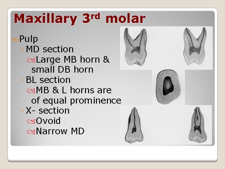 Maxillary 3 rd molar Pulp ◦ MD section Large MB horn & small DB