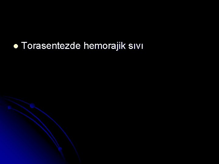 l Torasentezde hemorajik sıvı 