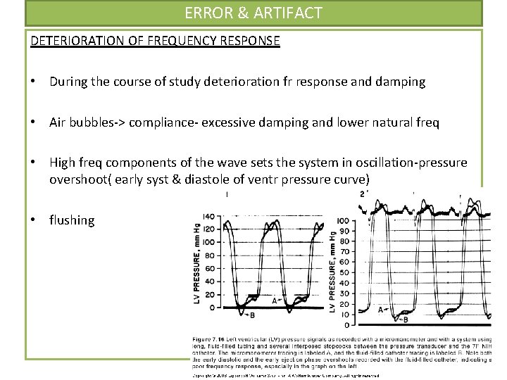 ERROR & ARTIFACT DETERIORATION OF FREQUENCY RESPONSE • During the course of study deterioration ERROR & ARTIFACT DETERIORATION OF FREQUENCY RESPONSE • During the course of study deterioration