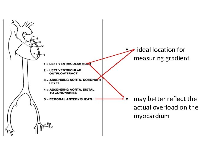 • ideal location for measuring gradient • may better reflect the actual overload • ideal location for measuring gradient • may better reflect the actual overload