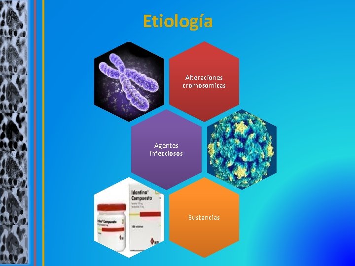 Etiología Alteraciones cromosomicas Agentes infecciosos Sustancias 
