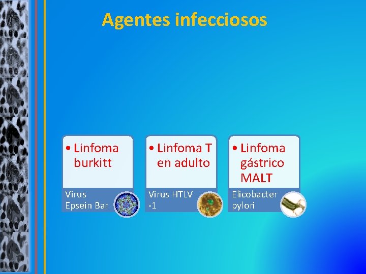 Agentes infecciosos • Linfoma burkitt • Linfoma T en adulto • Linfoma gástrico MALT