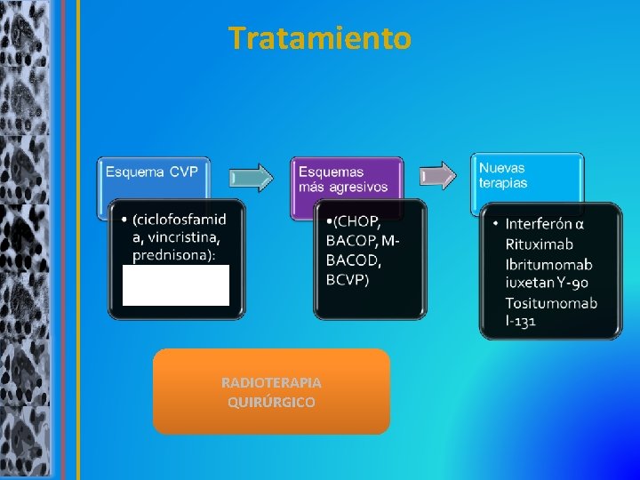 Tratamiento RADIOTERAPIA QUIRÚRGICO 