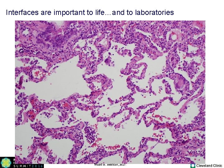 Interfaces are important to life…and to laboratories Walter H. Henricks, M. D. Interfaces are important to life…and to laboratories Walter H. Henricks, M. D.