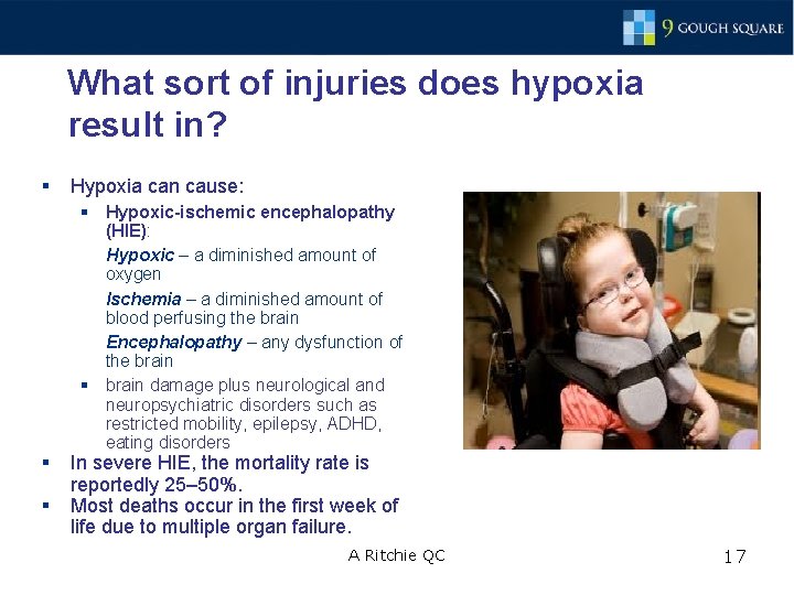 What sort of injuries does hypoxia result in? § § § Hypoxia can cause: