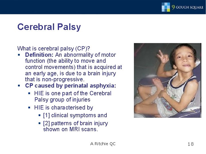 Cerebral Palsy What is cerebral palsy (CP)? § Definition: An abnormality of motor function