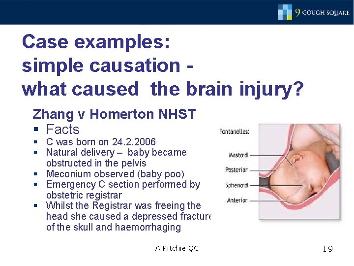 Case examples: simple causation - what caused the brain injury? Zhang v Homerton NHST