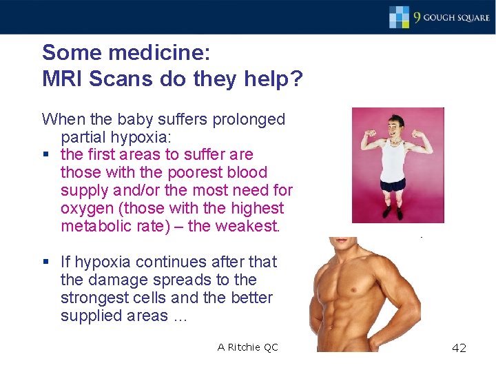 Some medicine: MRI Scans do they help? When the baby suffers prolonged partial hypoxia: