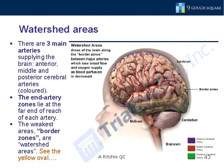 Watershed areas § There are 3 main arteries supplying the brain: anterior, middle and