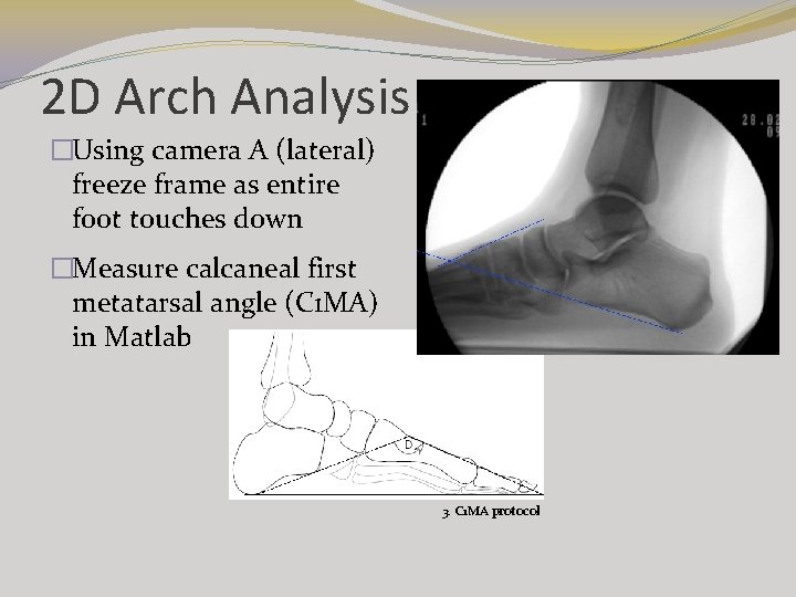 2 D Arch Analysis �Using camera A (lateral) freeze frame as entire foot touches 2 D Arch Analysis �Using camera A (lateral) freeze frame as entire foot touches