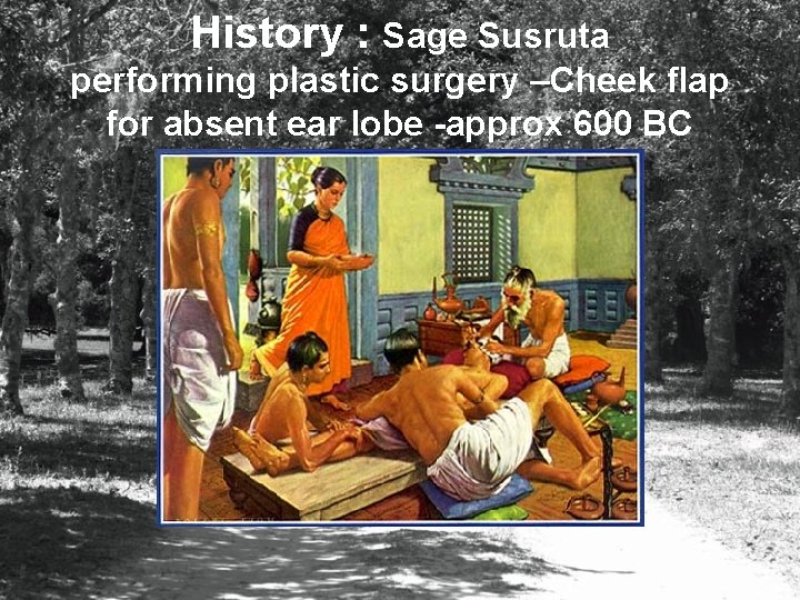 History : Sage Susruta performing plastic surgery –Cheek flap for absent ear lobe -approx