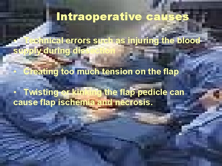 Intraoperative causes • Technical errors such as injuring the blood supply during dissection •