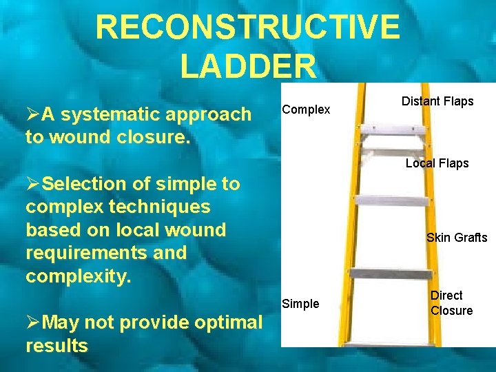 RECONSTRUCTIVE LADDER ØA systematic approach to wound closure. Complex Distant Flaps Local Flaps ØSelection