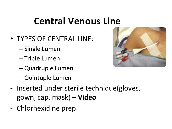 Central Venous Line • TYPES OF CENTRAL LINE: – Single Lumen – Triple Lumen