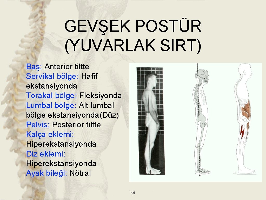 GEVŞEK POSTÜR (YUVARLAK SIRT) Baş: Anterior tiltte Servikal bölge: Hafif ekstansiyonda Torakal bölge: Fleksiyonda GEVŞEK POSTÜR (YUVARLAK SIRT) Baş: Anterior tiltte Servikal bölge: Hafif ekstansiyonda Torakal bölge: Fleksiyonda
