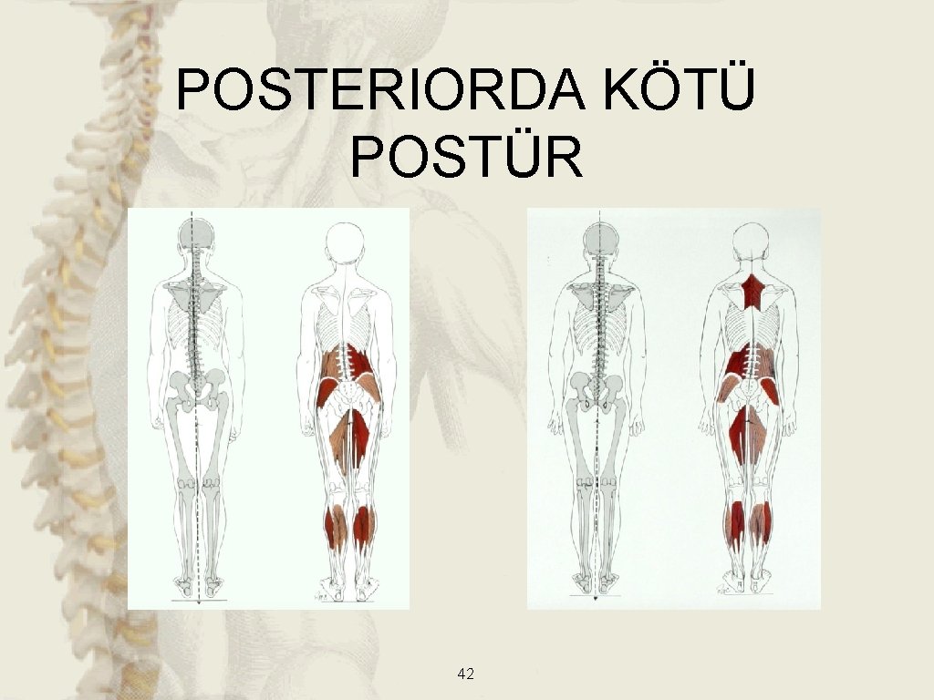 POSTERIORDA KÖTÜ POSTÜR 42 POSTERIORDA KÖTÜ POSTÜR 42