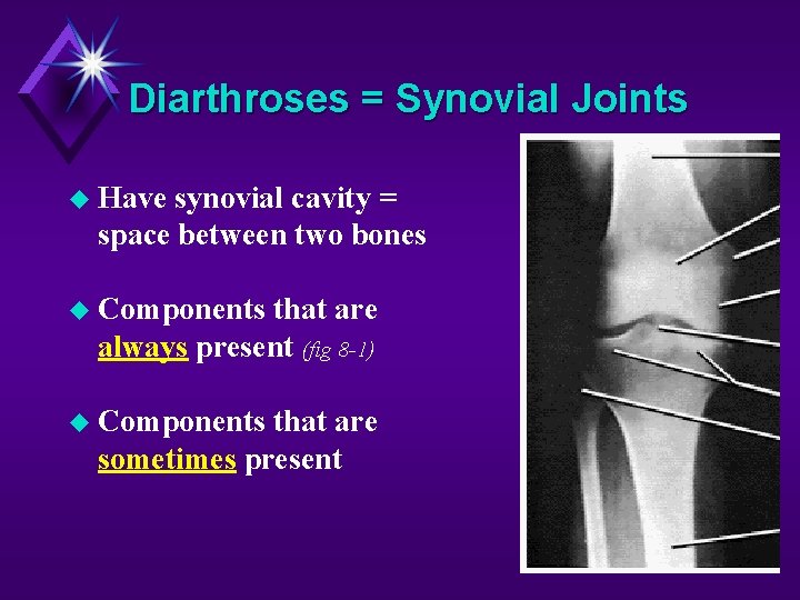 Diarthroses = Synovial Joints Have synovial cavity = space between two bones Components that