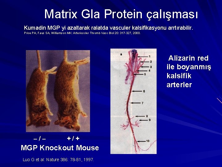 Matrix Gla Protein çalışması Kumadin MGP yi azaltarak ralatda vasculer kalsifikasyonu arrtırabilir. Price PA,