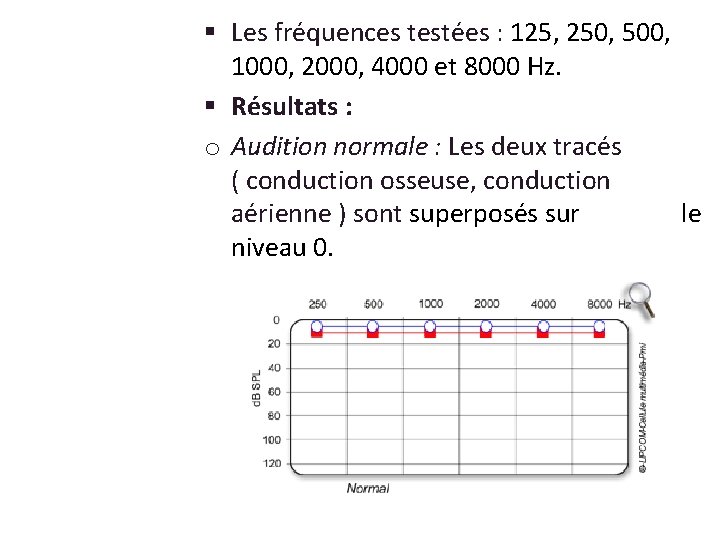 § Les fréquences testées : 125, 250, 500, 1000, 2000, 4000 et 8000 Hz.