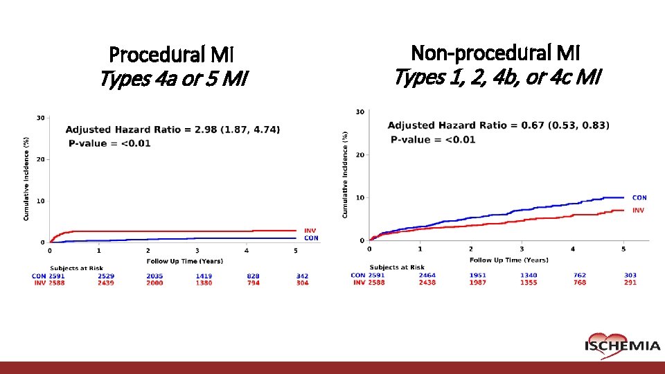Procedural MI Types 4 a or 5 MI Cardiovascular Clinical Research Center Non-procedural MI Procedural MI Types 4 a or 5 MI Cardiovascular Clinical Research Center Non-procedural MI