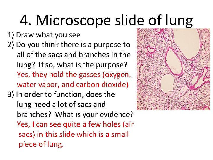 4. Microscope slide of lung 1) Draw what you see 2) Do you think